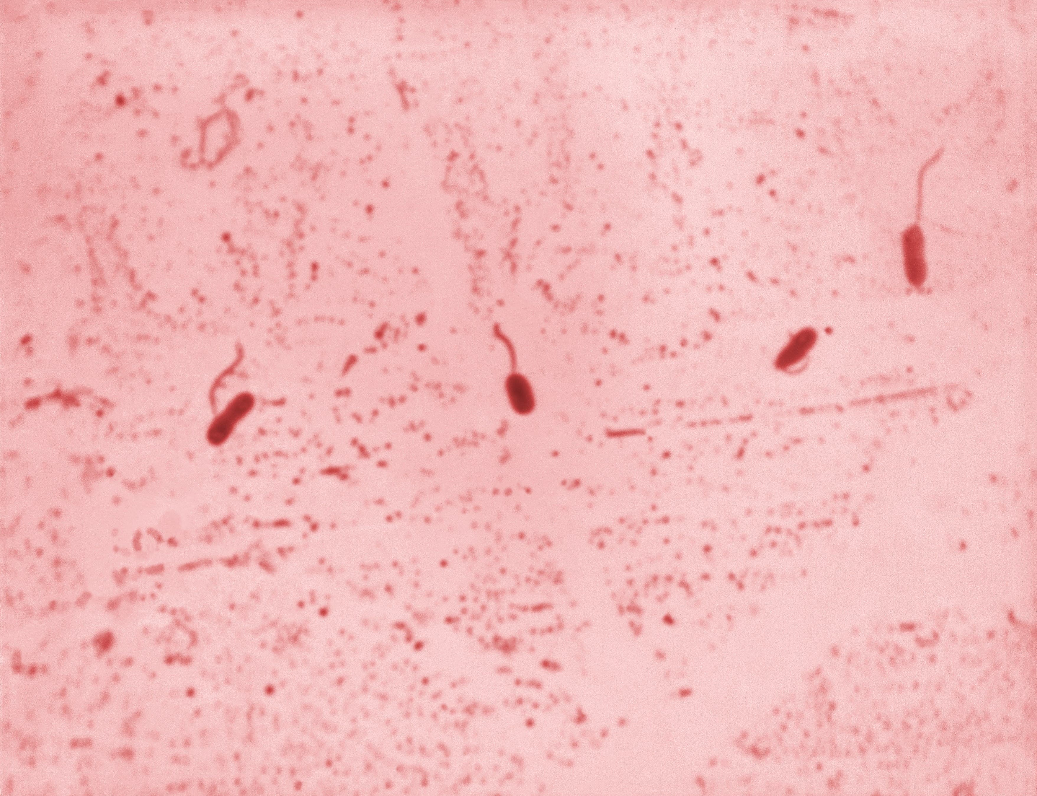 A light micrograph of a Gram-stained smear showing four curved, rod-shaped Vibrio cholerae bacteria, each with a single flagellum at one end, against a pink background of stained debris.